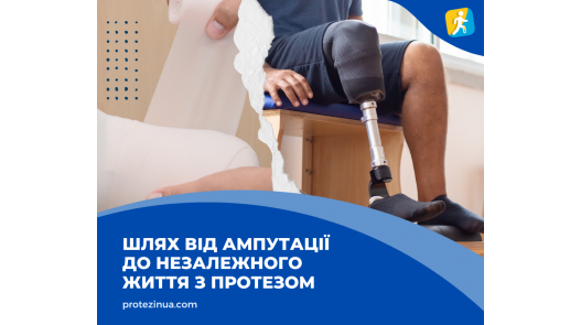Шлях від ампутації до незалежного життя з протезом